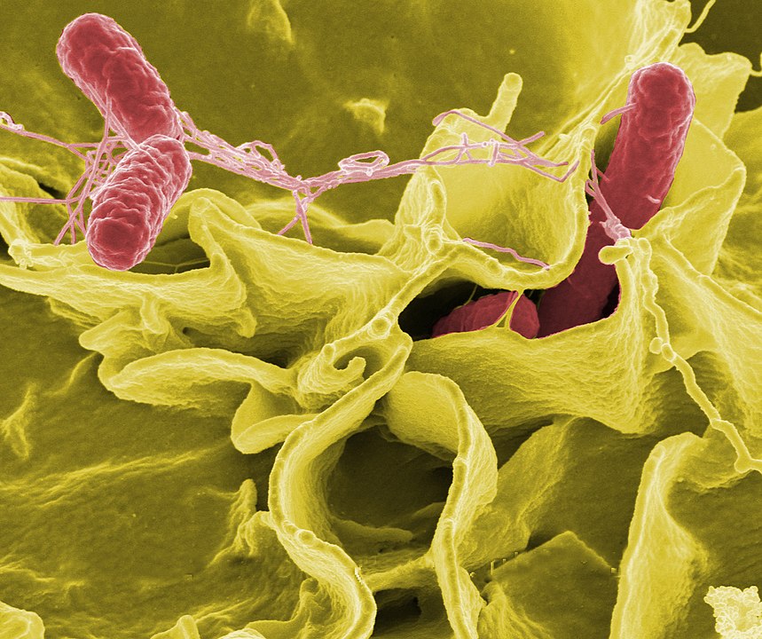 microscope photo of salmonella from Rocky Mountain Labs for "Who's to Blame" 50 word fiction story by Jenise Cook